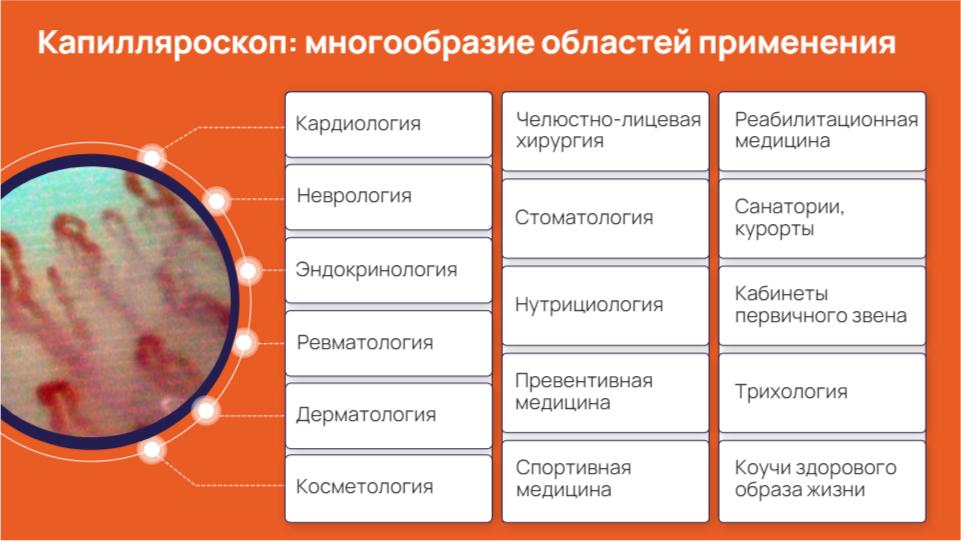 prezentacziya kapillyaroskop.pdf page 7 of 14 Проект «Капилляроскоп»