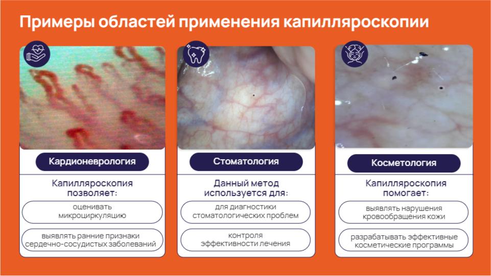 prezentacziya kapillyaroskop.pdf page 8 of 14 Проект «Капилляроскоп»